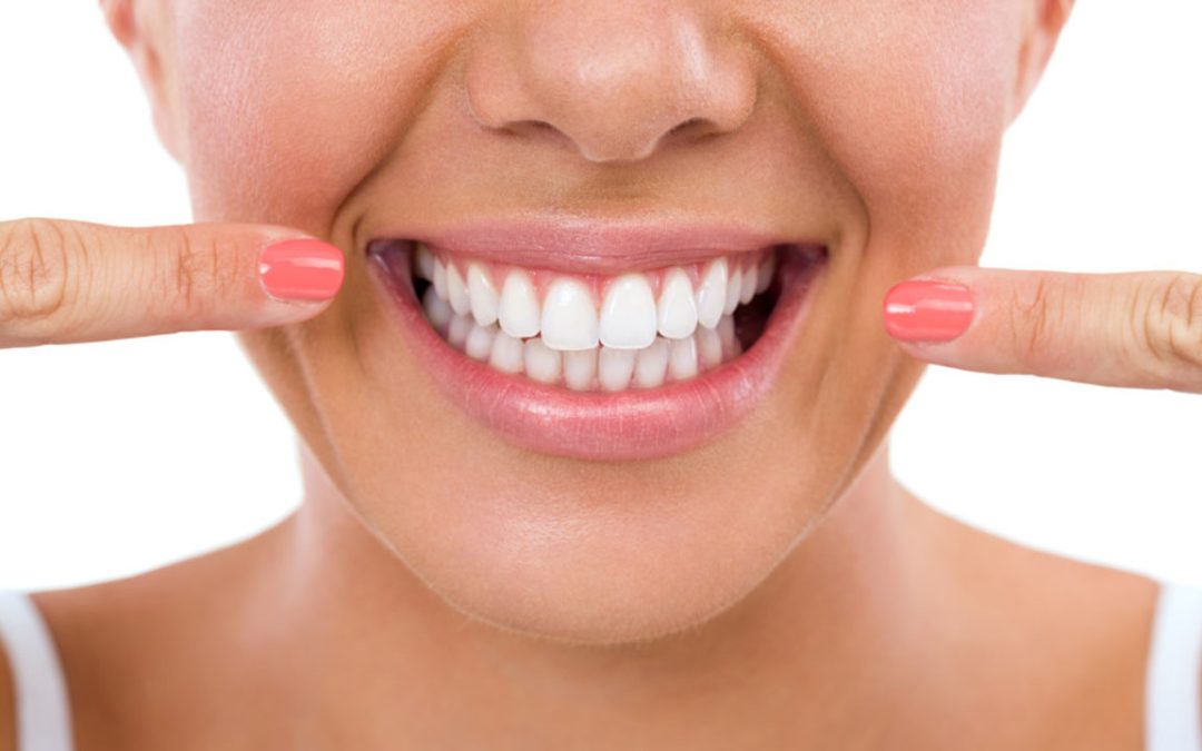 Perché sbiancare i denti in estate?