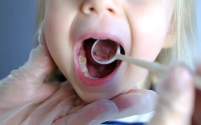Importanza della Prevenzione Dentale nei Bambini