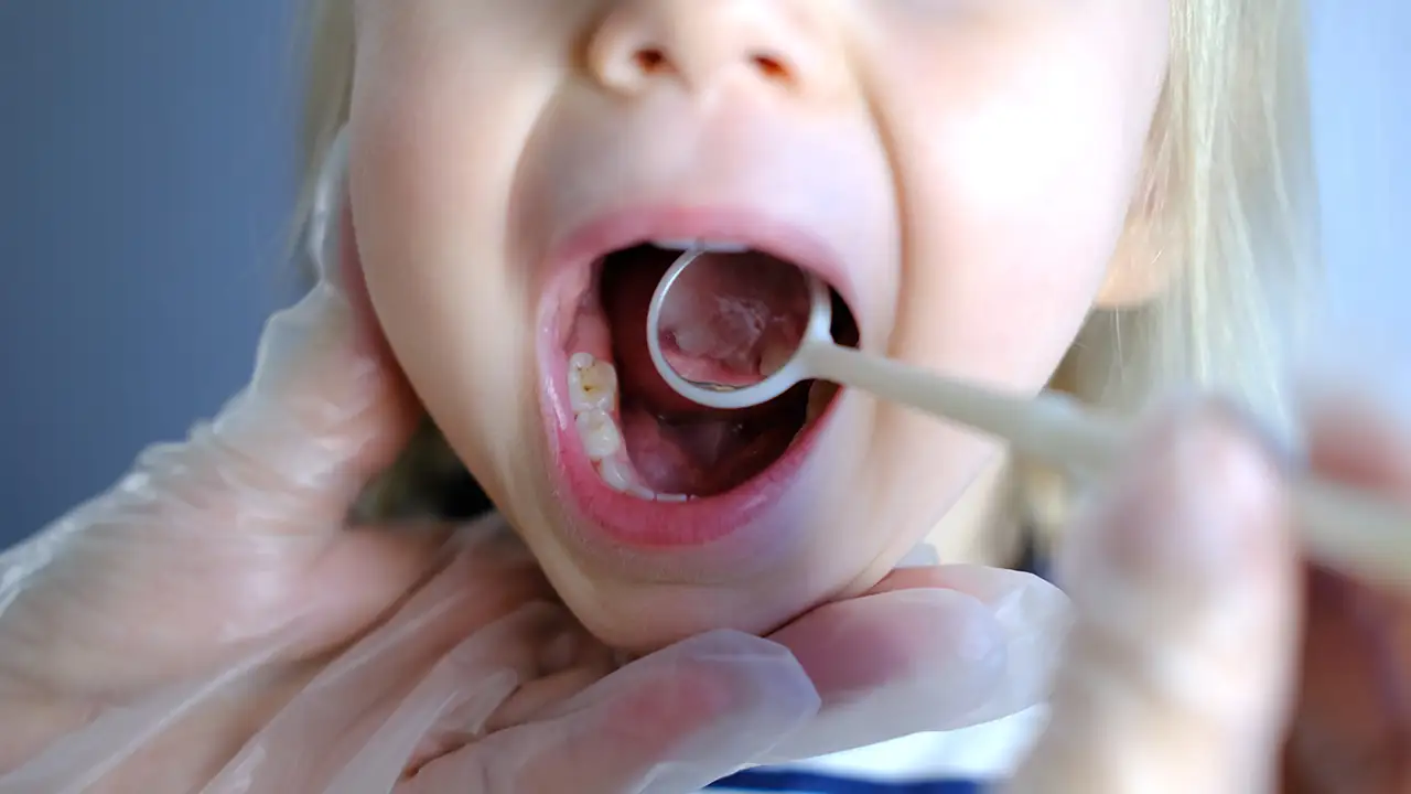Importanza della Prevenzione Dentale nei Bambini – Studio Fiammenghi Importanza della Prevenzione Dentale nei Bambini - Studio Fiammenghi
