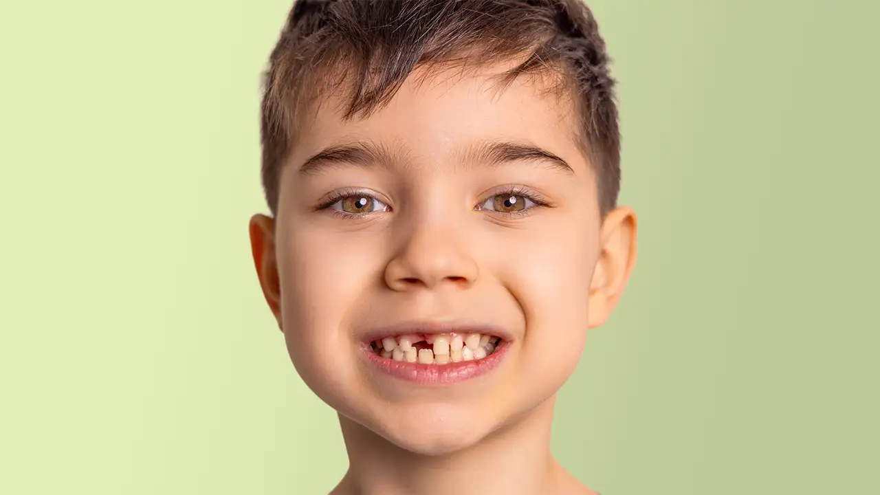 Cura dei Denti da Latte – Perché È Importante e Come Mantenerli Sani – Studio Fiammenghi – Dentista Cura dei Denti da Latte - Perché È Importante e Come Mantenerli Sani - Studio Fiammenghi - Dentista