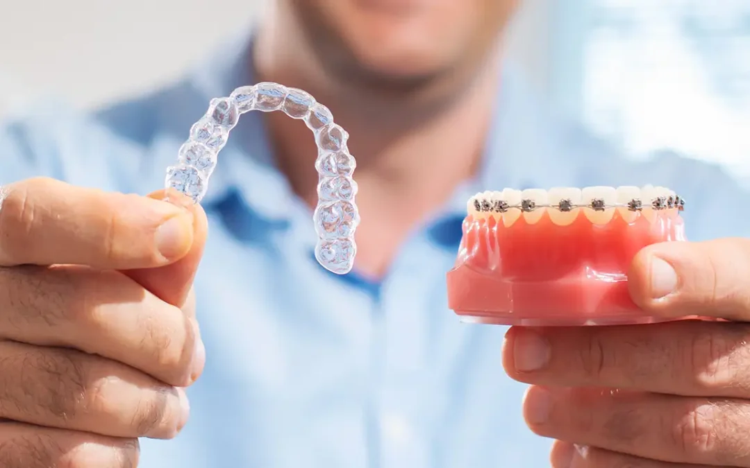 Apparecchio fisso o allineatori trasparenti? Tutto quello che c’è da sapere per scegliere il trattamento ortodontico più adatto