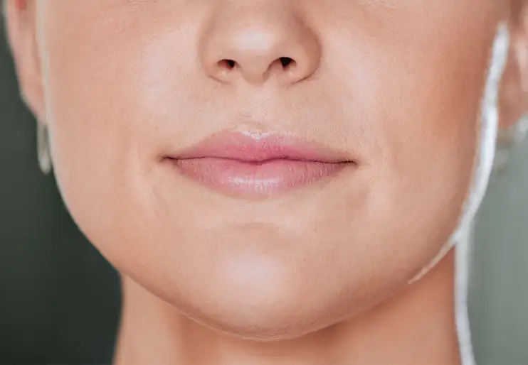 Fiammenghi - Filler Labbra