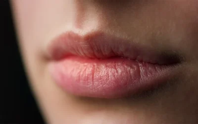 Filler Labbra e Armonia del Sorriso a Brescia: Come l’Acido Ialuronico Valorizza il Risultato Odontoiatrico