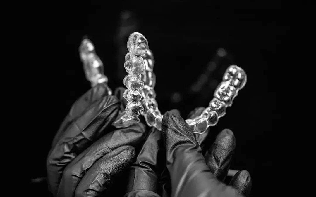 Buttons e Attachments negli Allineatori Invisibili a Brescia: Cosa Sono e Perché Fanno la Differenza nel Tuo Trattamento