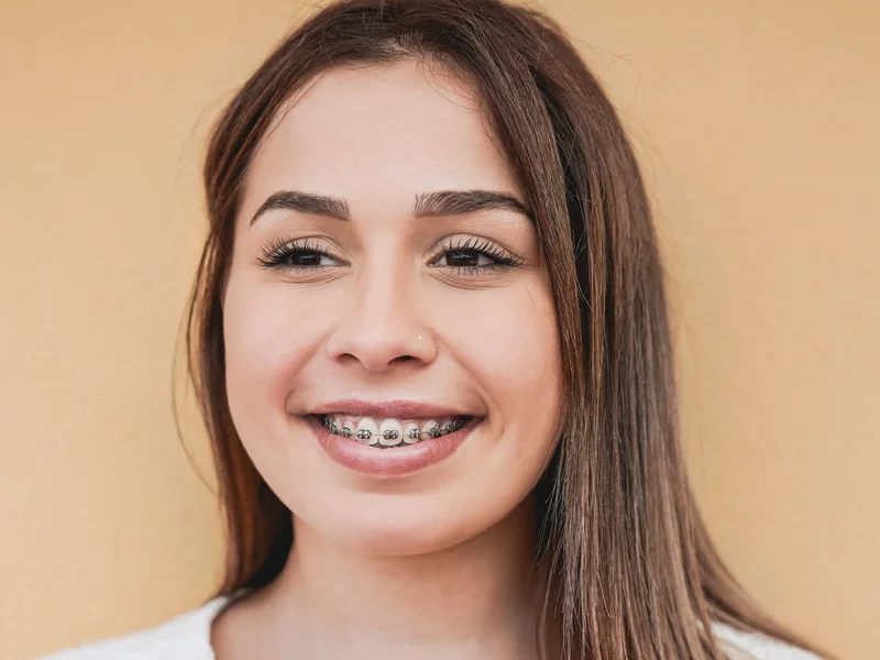 Ragazza sorride con un apparecchio fisso