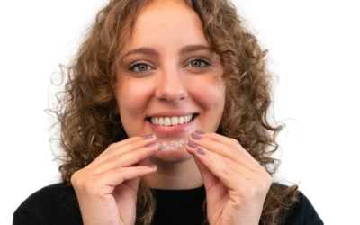 Il refinement con gli allineatori trasparenti: quando e perché si ottimizza il risultato finale a Brescia